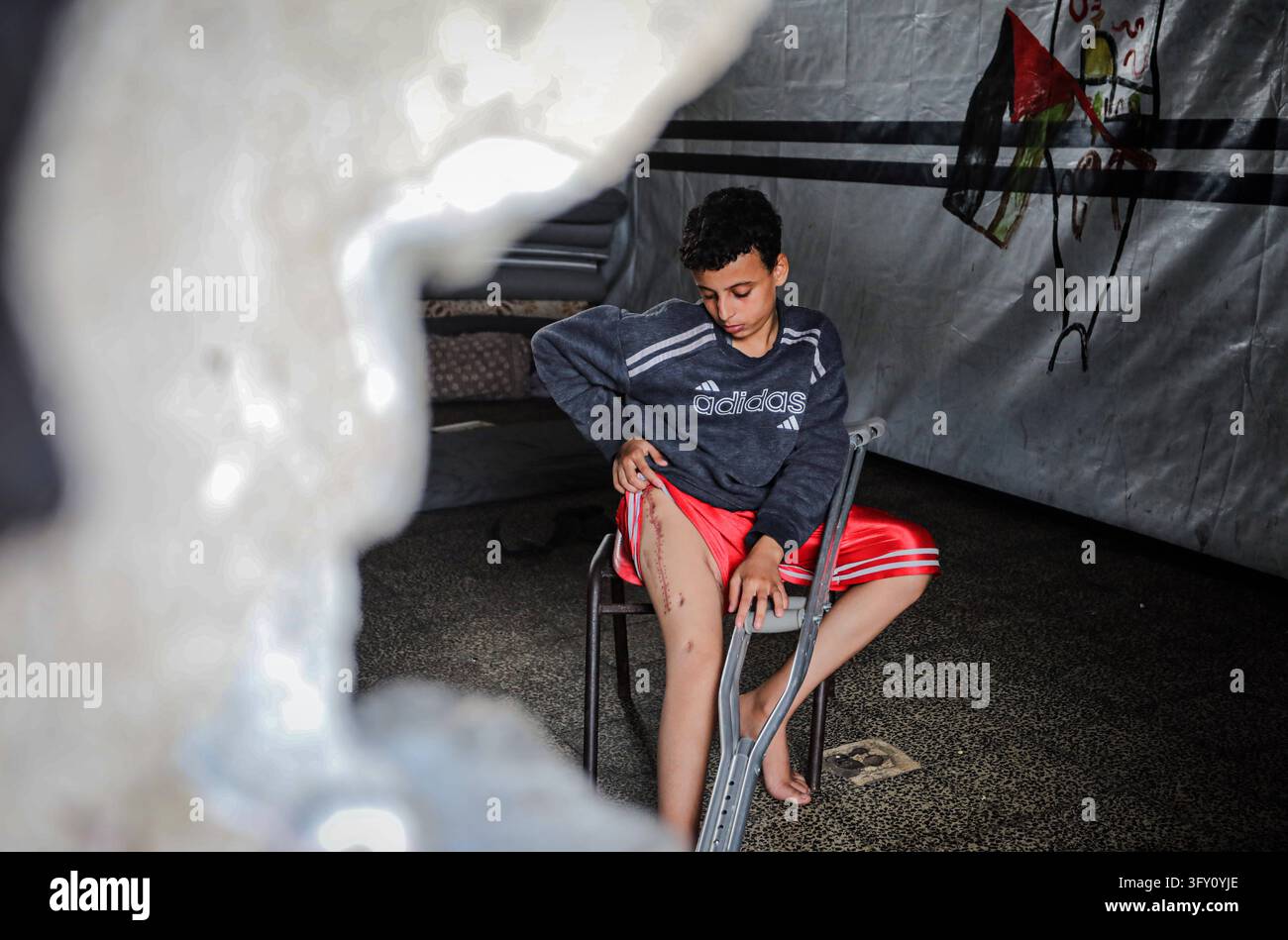 Palestinian Plate Palestinian Boy Who Lost Family in Israeli Strike Awaits Treatment ...