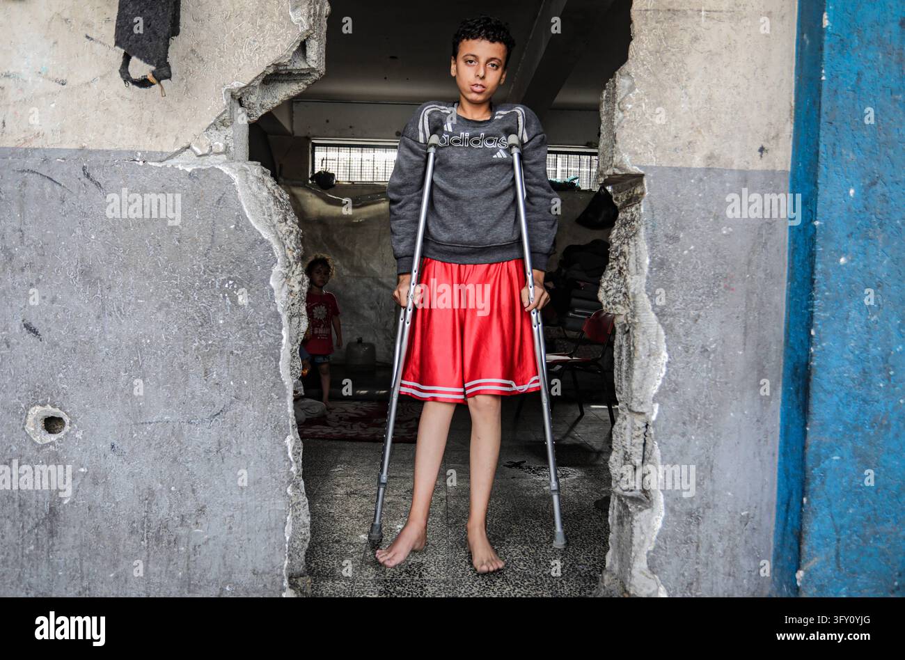 Palestinian Plate Palestinian Boy Who Lost Family in Israeli Strike Awaits Treatment ...