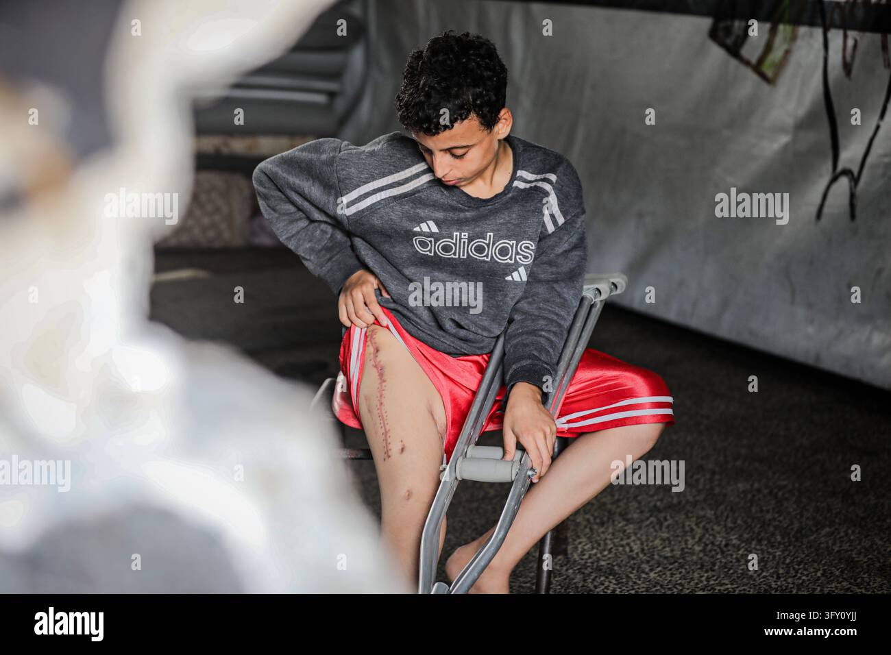 Palestinian Plate Palestinian Boy Who Lost Family in Israeli Strike Awaits Treatment ...