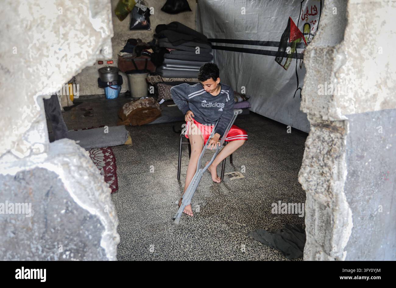 Palestinian Plate Palestinian Boy Who Lost Family in Israeli Strike Awaits Treatment ...
