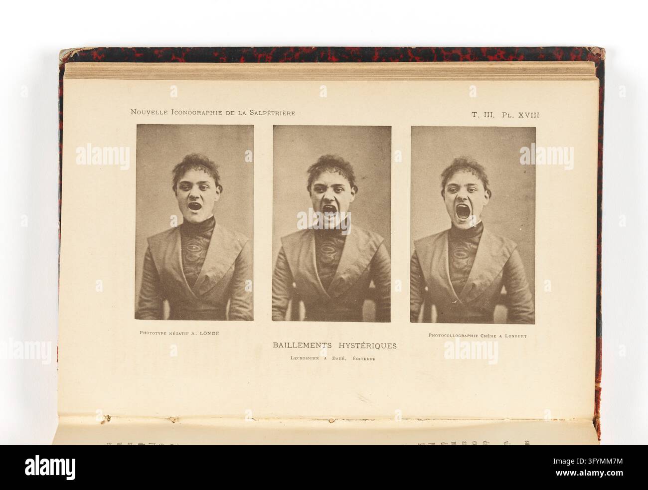 Nouvelle iconographie de la Salpetriere Stock Photo - Alamy