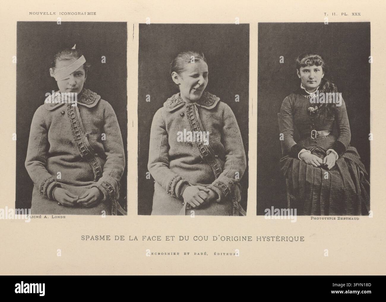 Nouvelle iconographie de la Salpetriere Stock Photo - Alamy