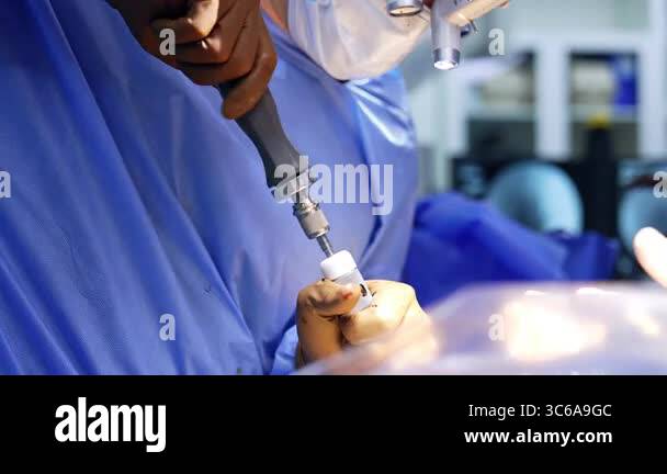 Male surgeon holds and applies medical instrument. Gloved hands of the ...