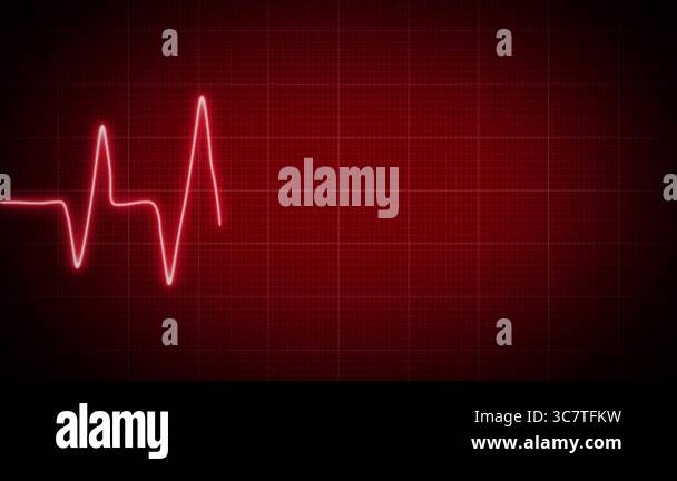 ECG showing loss of heartbeat neon line animation on grid background ...