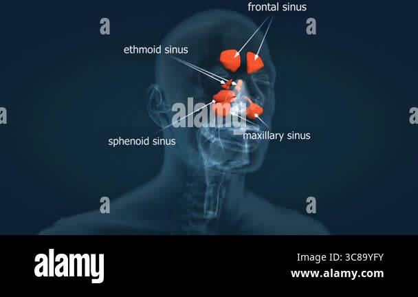 Sinuses Animation 3D animation of the anatomy of paranasal sinuses, showing their ...