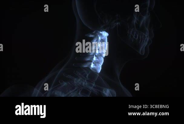 Neck x ray of cervical vertebrae Stock Videos & Footage - HD and 4K ...