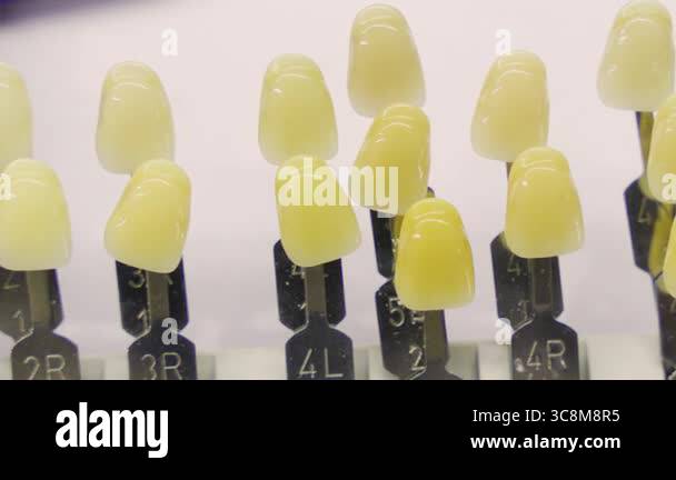 Close-up of a tooth shade guide with various tooth color samples used ...