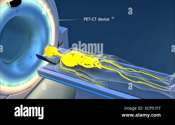 3D animation illustrating tumours diagnostic process and imaging ...