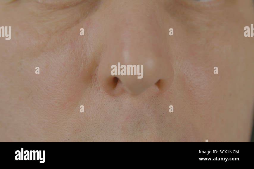 Close up male nose front view. Plastic surgery. Respiratory and ...