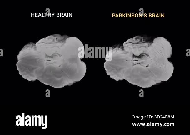 Axial pathway Stock Videos & Footage - HD and 4K Video Clips - Alamy