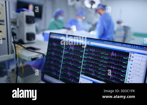 Computer monitor with brain waves. Close up. Equipment in surgery room ...