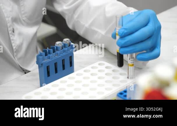 Close up of laboratory technician with blue gloves using pipette to ...