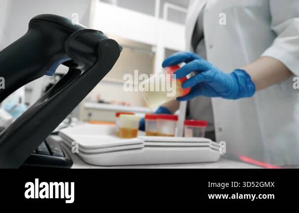 Scientist in blue gloves scanning urine sample barcode with laboratory ...