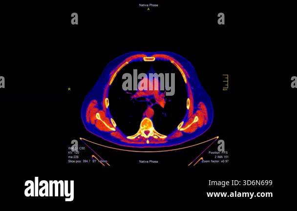 Detailed animation of colorful computed tomography (CT) scan slices ...