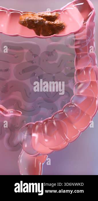 Anatomy of the human digestive system, concept of the intestine, alpha ...