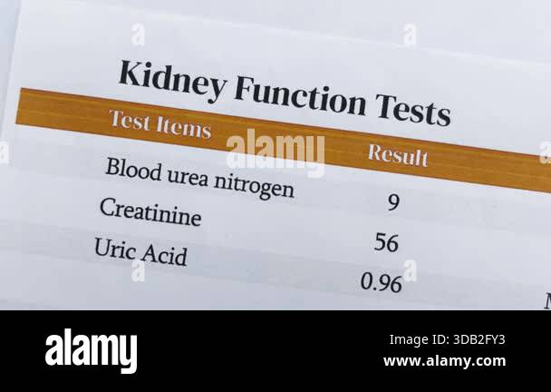 Kidney function test report 4k footage close up with orange bar and ...