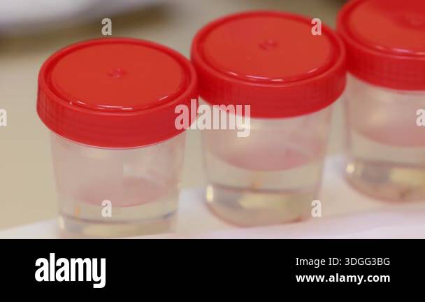 Plastic medical sample containers with red lids in laboratory setting ...