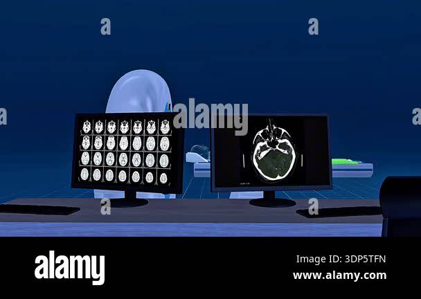 3d animation of CT scan showing patient table, rotating x-ray tube ...