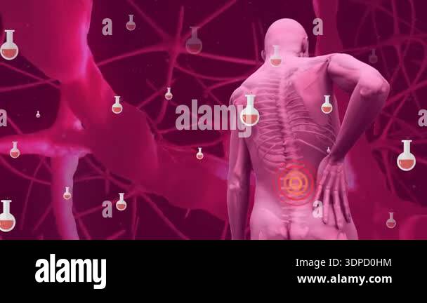Animation of chemical beaker over human body model holding his back ...