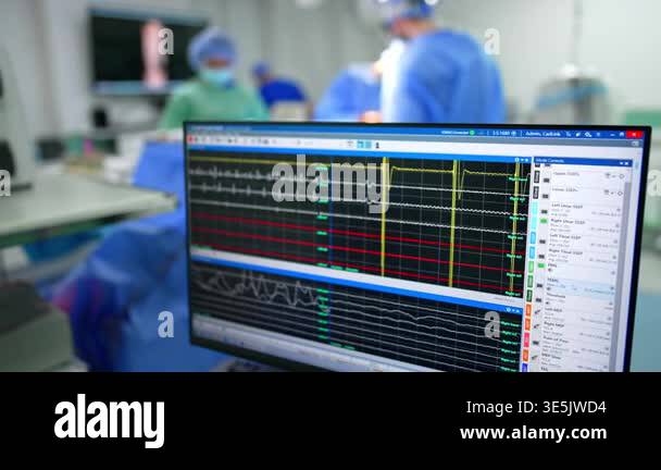 Computer screen with running curved lines. Medical team works at ...