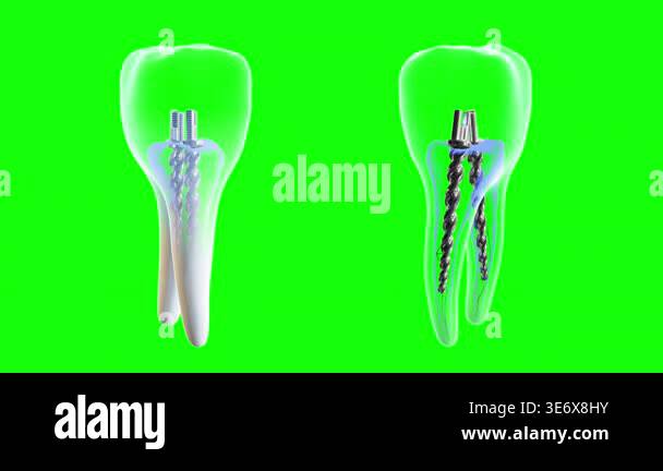 3d tooth green screen animation. Isolated rotating 3d tooth model ...