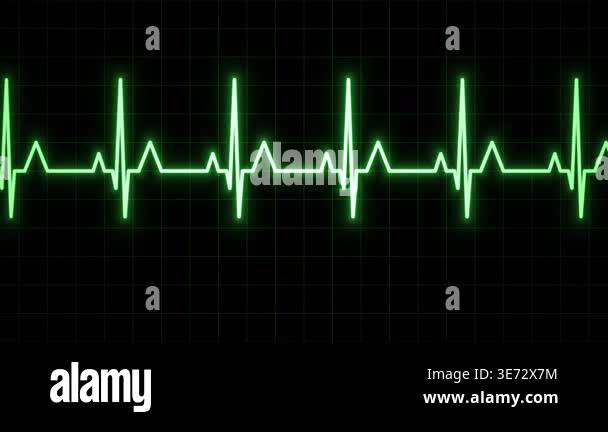 Heartbeat Monitor Display Animation on Black Grid Screen Stock Video ...