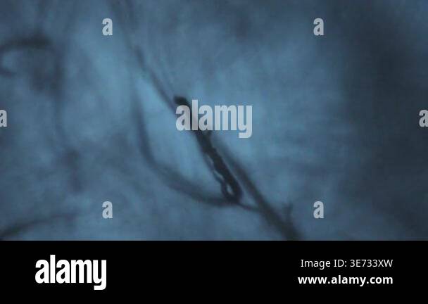 Threads moving seen through an optical microscope Stock Video Footage ...