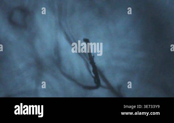 Threads filaments moving seen through an optical microscope Stock Video ...