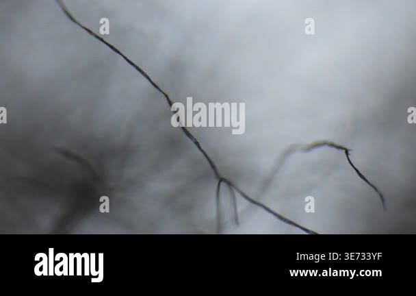 Threads moving seen through an optical microscope Stock Video Footage ...