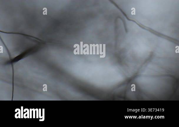 Focusing lint filaments and threads through an optical microscope Stock ...