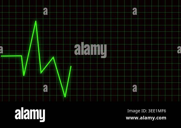 Green ECG heartbeat line animation medical technology cardiogram pulse ...
