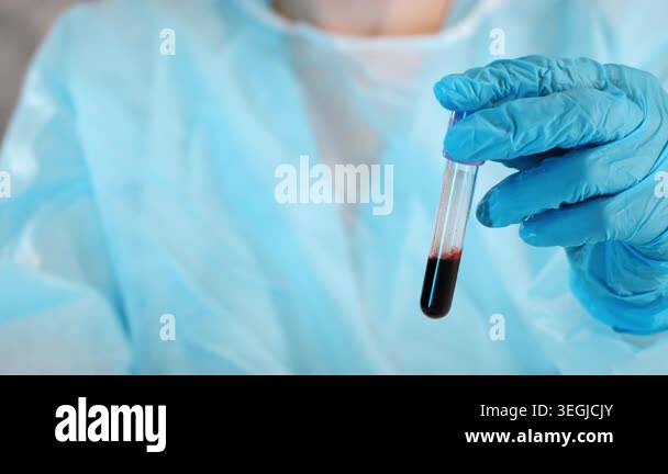 Close up of laboratory worker in protective gloves holding blood sample ...