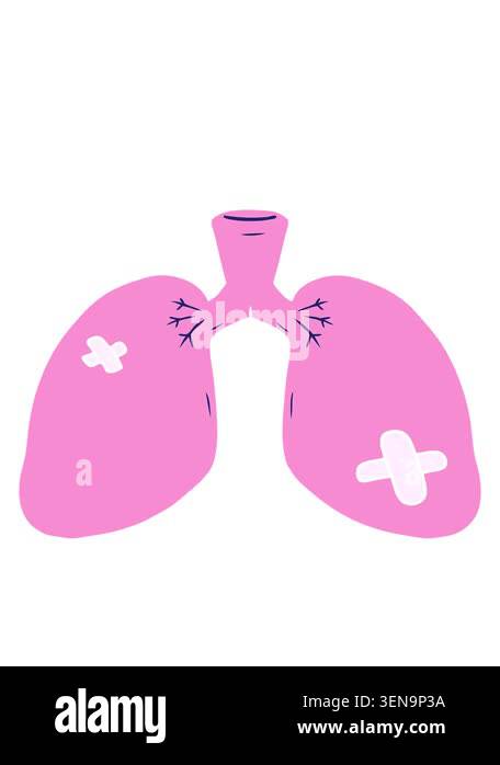 bobbing motion animation of flat color style cartoon repaired lungs ...