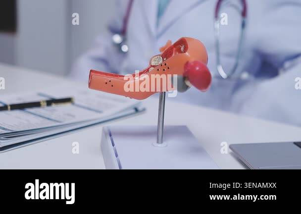 young woman doctor holding dental jaw model Stock Video Footage - Alamy