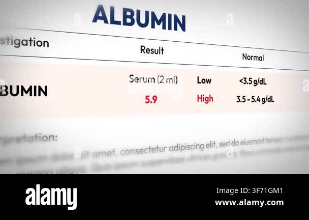 High serum albumin blood test results in medical report analysis for ...