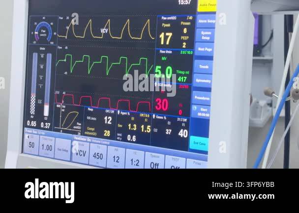 Medical equipment in hospital modern heart rate monitor in operating ...