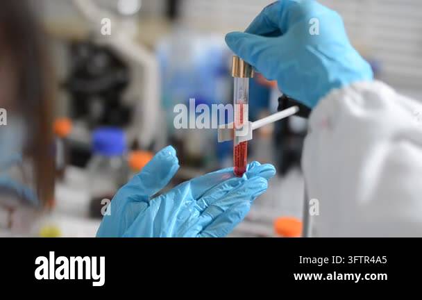 Sample Yuve scientist holding tube with blood sample Stock Video Footage - Alamy