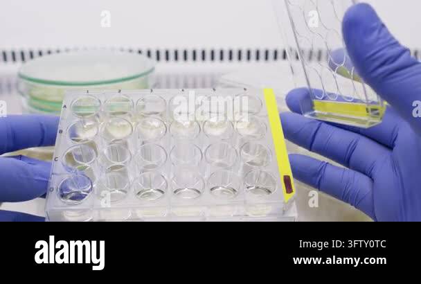 Human cell culture in immunological plate wells; analysis of human cell ...