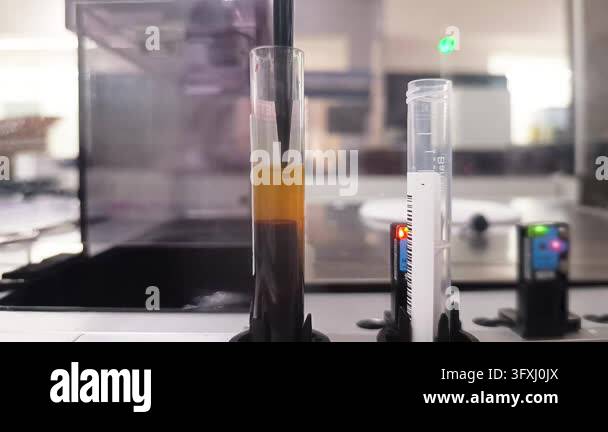 Automated aliquoter close-up in medical laboratory separating blood ...