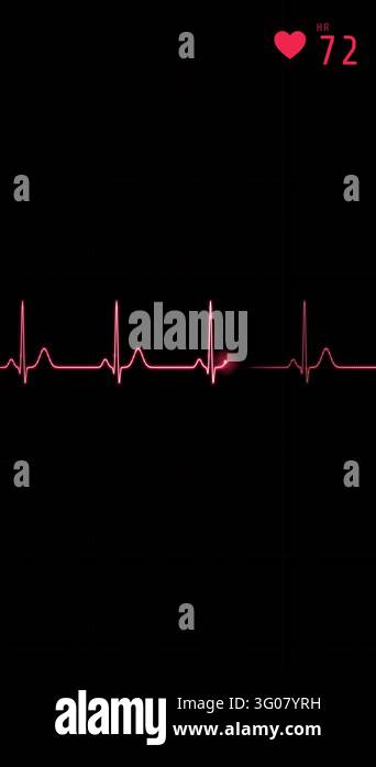 A red ECG heartbeat line traces steady beats across a black vertical ...
