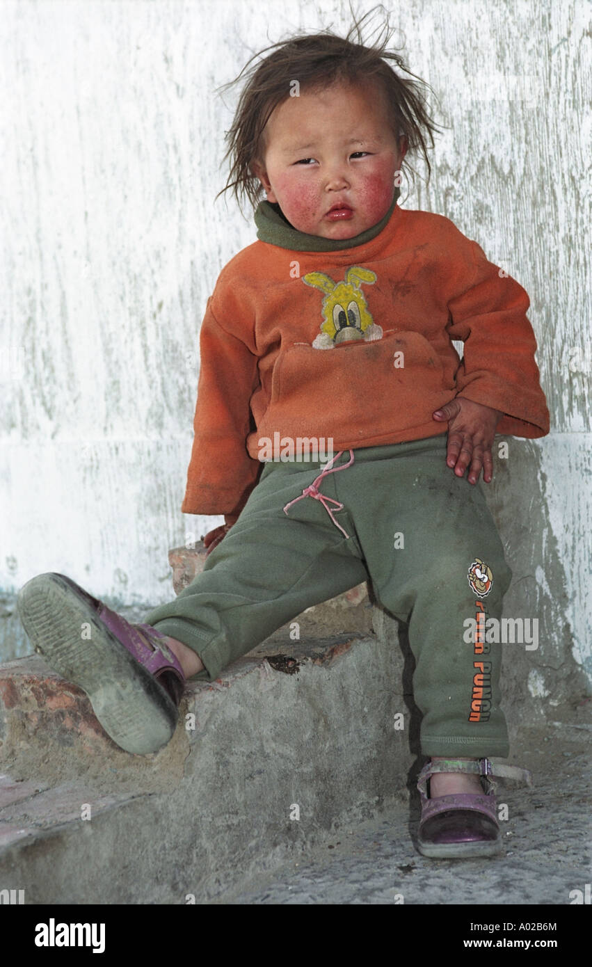 Portrait of a baby. Kid has red dust allergy cheeks. Khongo brigade, Barun Gol River, Khovd aimag (province). Mongolia Stock Photo