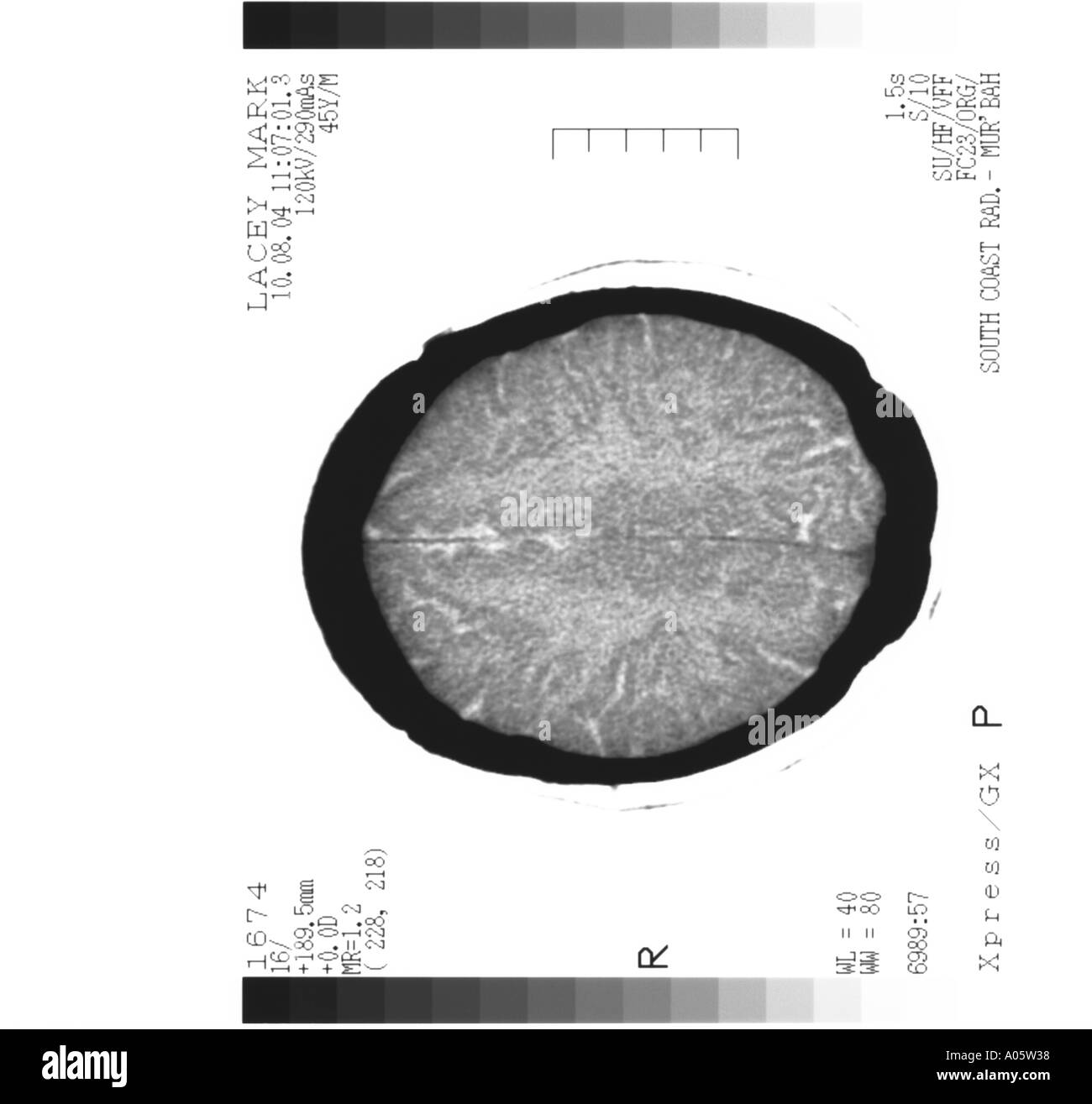 brain scan cross section Stock Photo