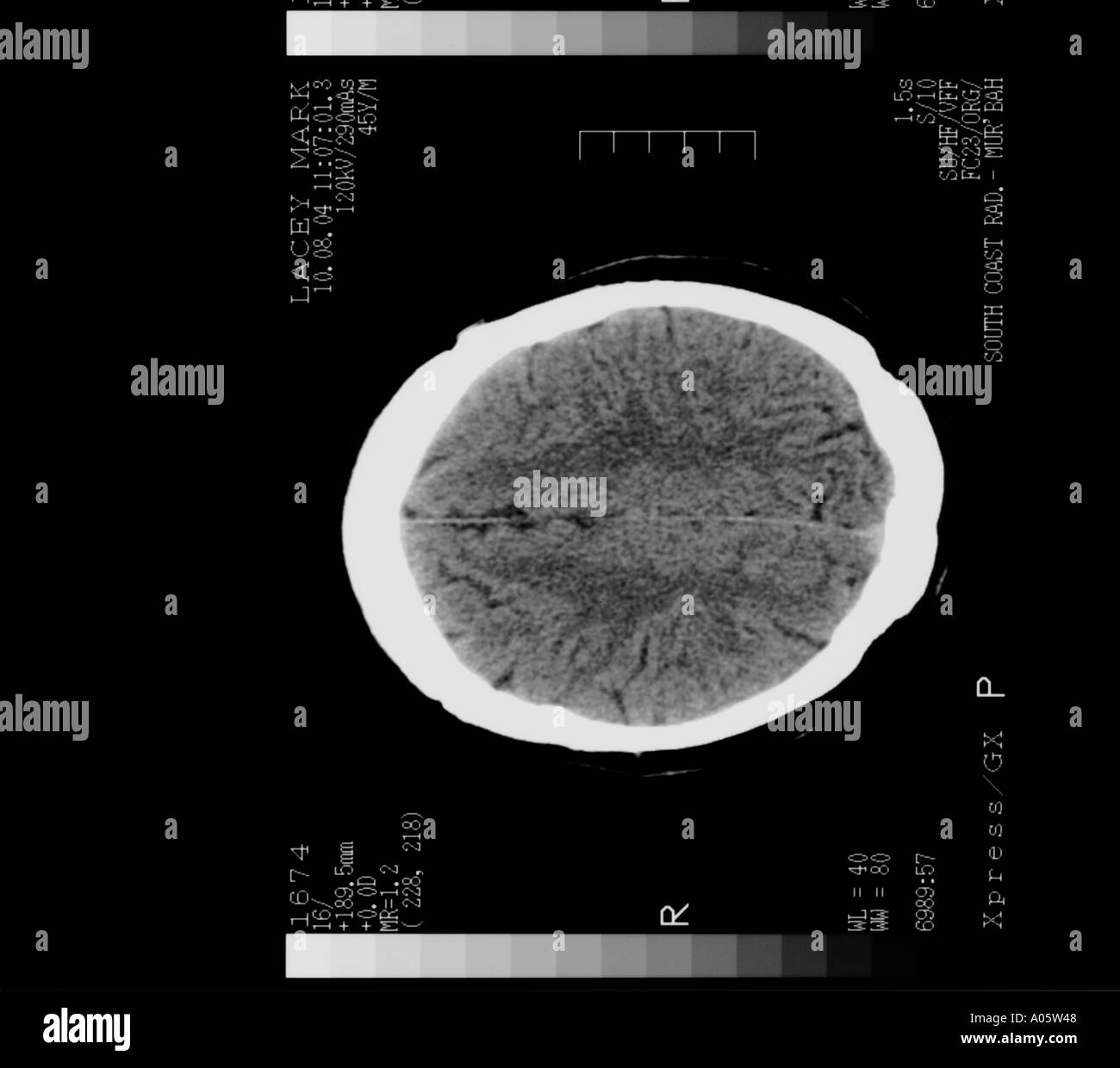 brain scan cross section Stock Photo