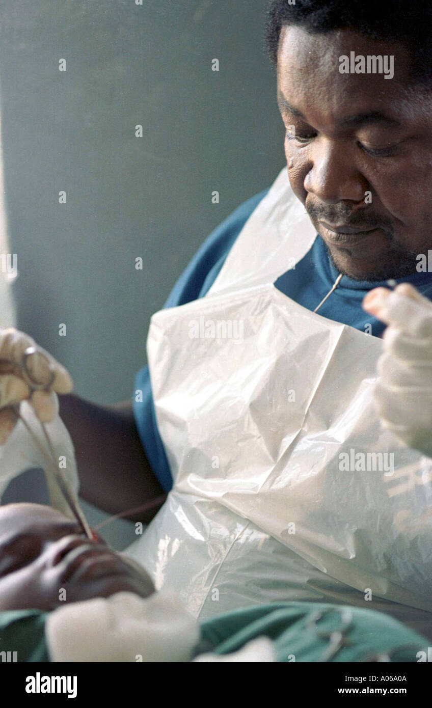 An operation to reverse Trachoma being carried out in a Malawian field hospital  Stock Photo