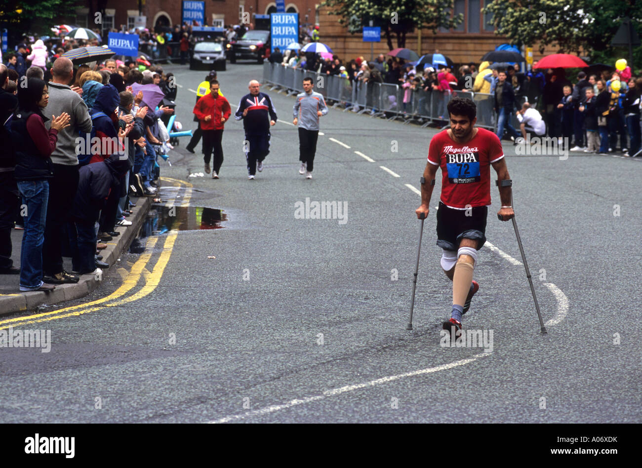 Amputated legs hires stock photography and images Alamy