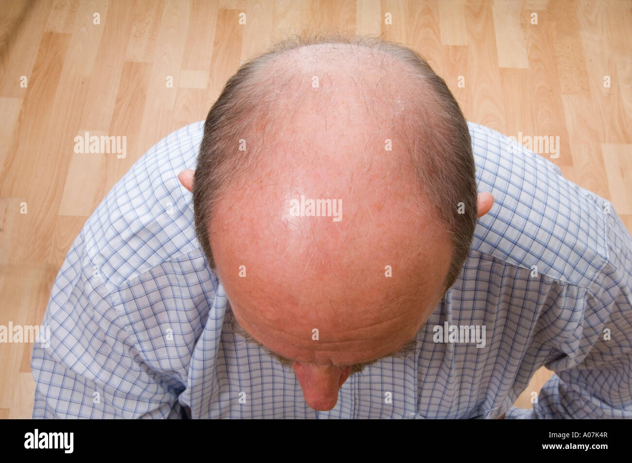 A bald head of a white man Stock Photo