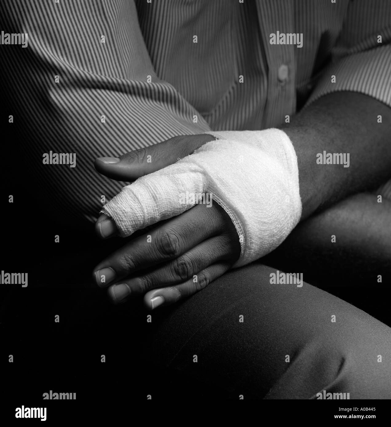 hand injury Stock Photo