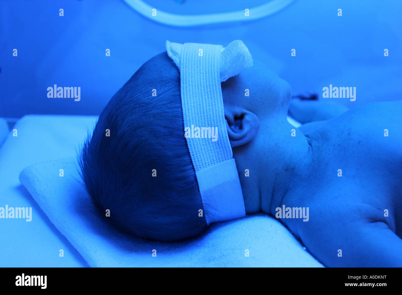 Baby under phototherapy hires stock photography and images Alamy