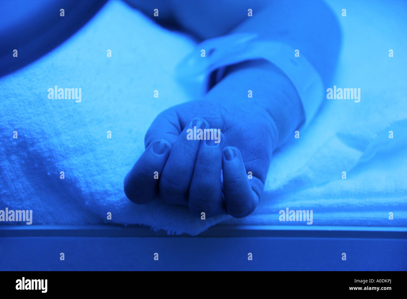 Premature baby with jaundice having phototherapy Stock Photo