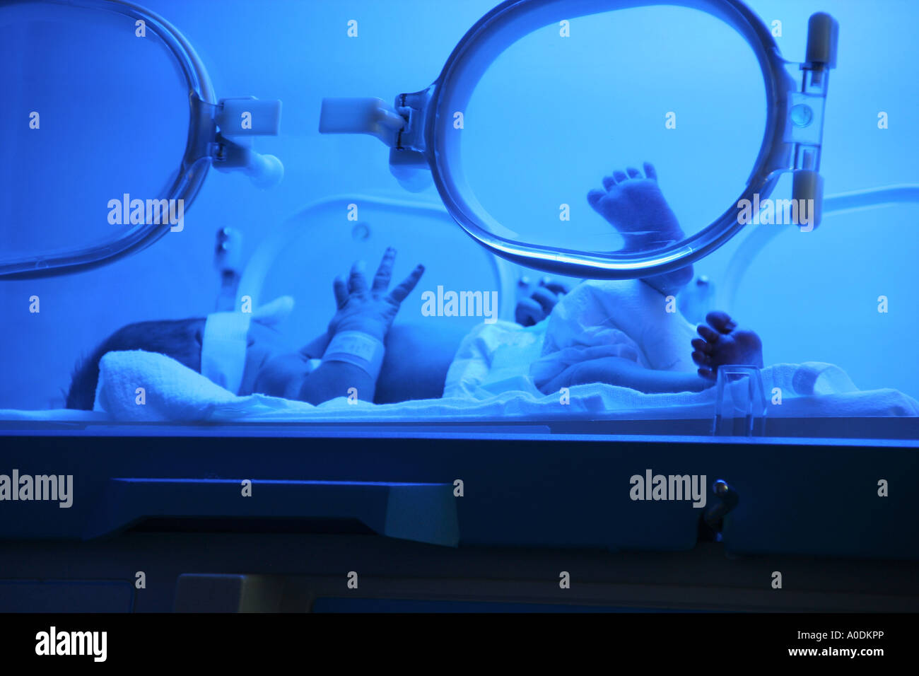 Baby under phototherapy hires stock photography and images Alamy